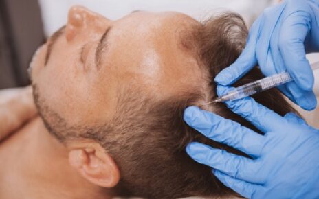4 Things You Didn't Know About the Stem Cell Hair Treatment